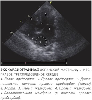 что такое мембрана в сердце. Смотреть фото что такое мембрана в сердце. Смотреть картинку что такое мембрана в сердце. Картинка про что такое мембрана в сердце. Фото что такое мембрана в сердце