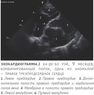 что такое мембрана в сердце. Смотреть фото что такое мембрана в сердце. Смотреть картинку что такое мембрана в сердце. Картинка про что такое мембрана в сердце. Фото что такое мембрана в сердце